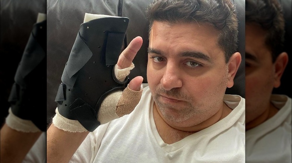 Buddy Valastro holding up injured hand after third surgery