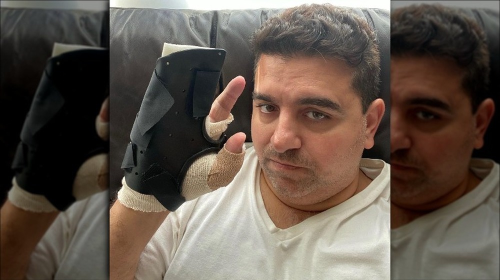 Buddy Valastro showing his injured hand in bandages