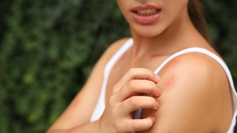 woman itching scratchy skin