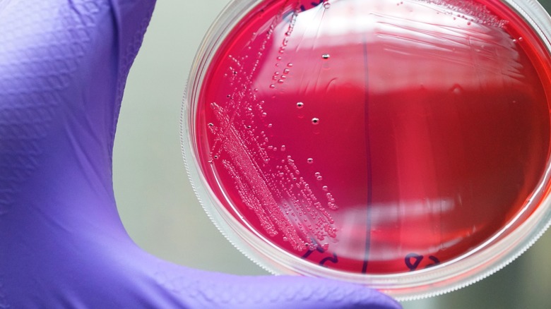 Salmonella colonies in petri dish 