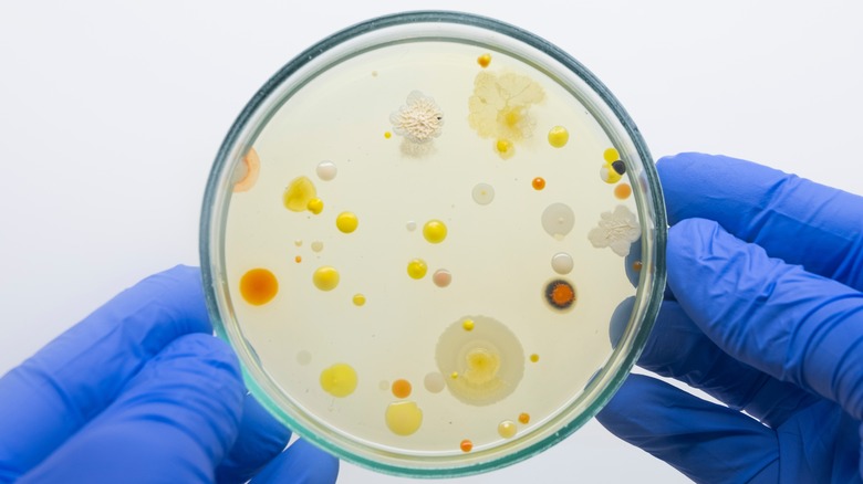 bacteria in a petri dish