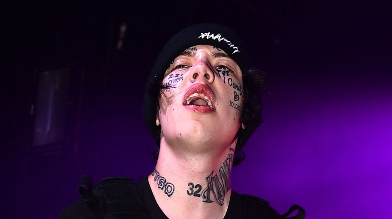 Rapper Lil Xan ate too many flamin hot cheetos