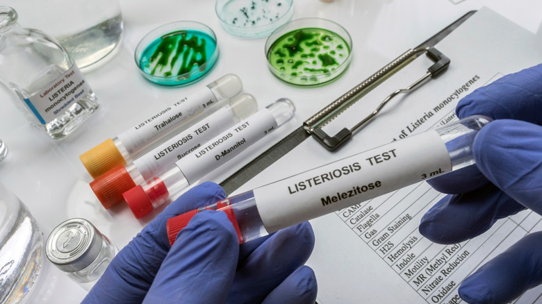 Listeria tests being conducted in a lab