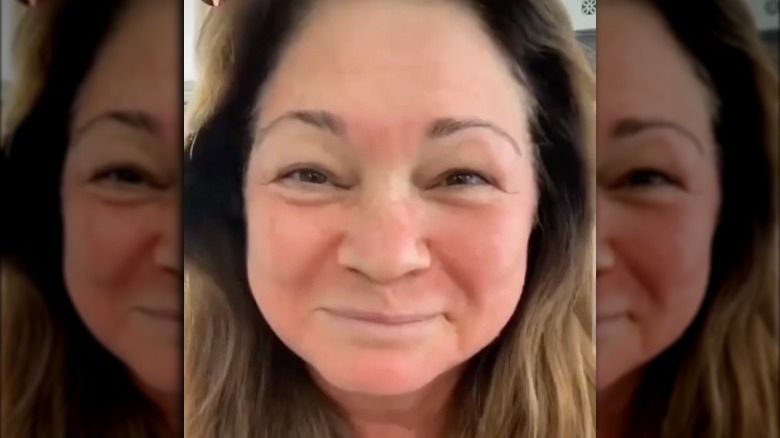 Valerie Bertinelli after vampire facial