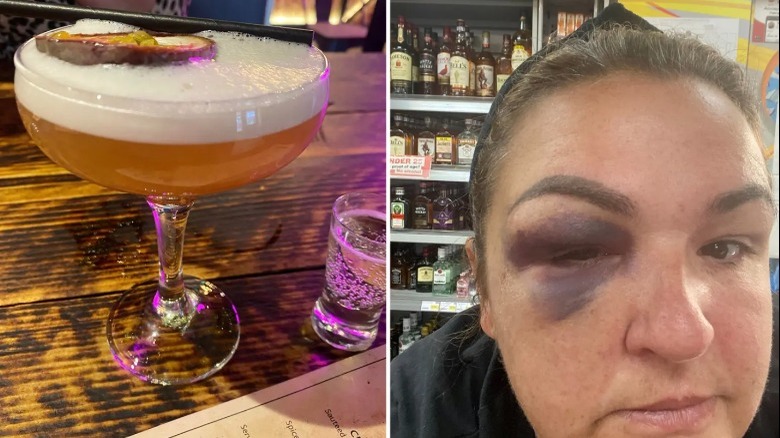 Nat Cooper with a black eye and a pornstar martini