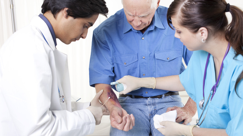 doctors tending burn wound